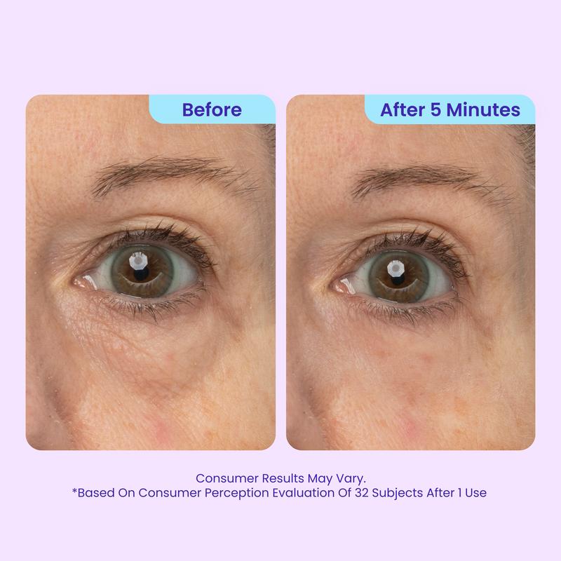 Instant Lift Eye Gel